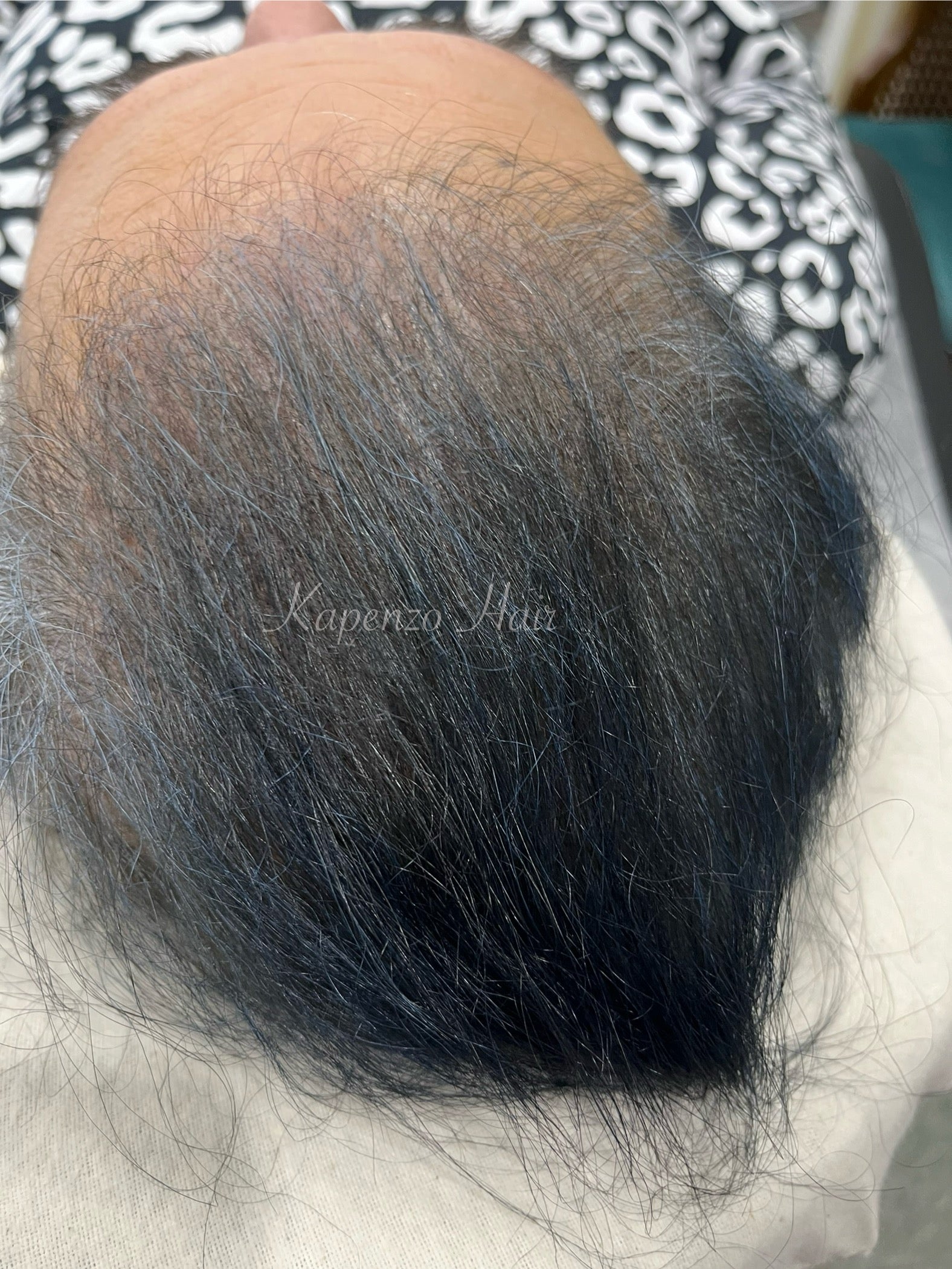 SCALP MICROPIGMENTATION KAPENZO HAIR